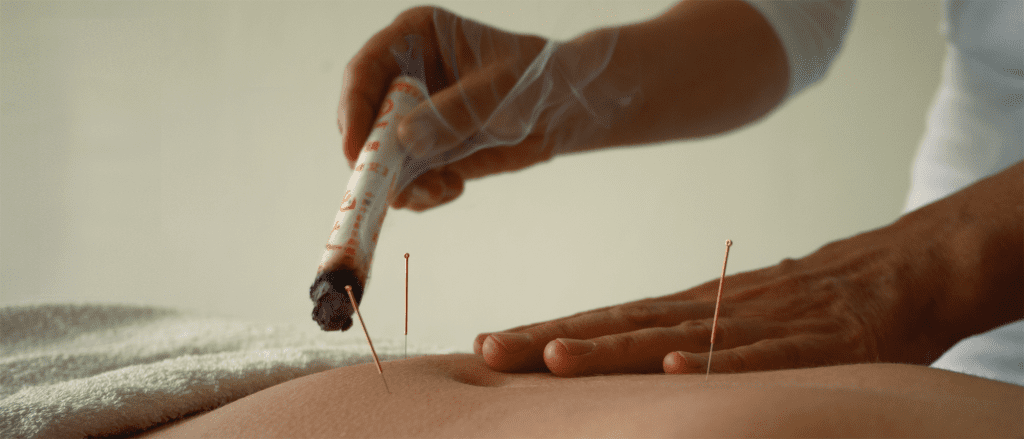 moxatherapie bij burn-out of overspannenheid