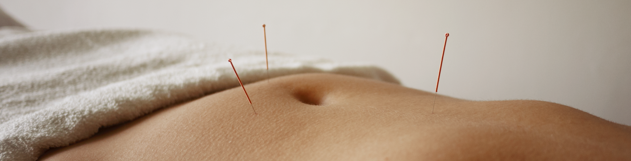 In de praktijk voor acupunctuur ziet u een buik met drie naalden rondom de buik